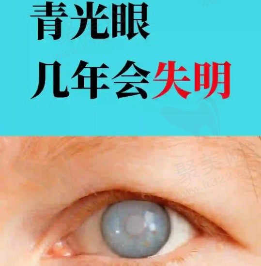青光眼会失明吗？听说青光眼到非常后都是瞎是真的吗？