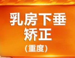 杭州美莱栗勇缩胸价格5w元起，巨乳缩小下垂矫正术后反馈良好