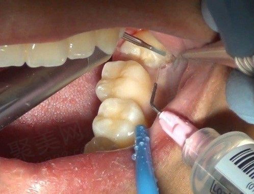 WechatIMG13801