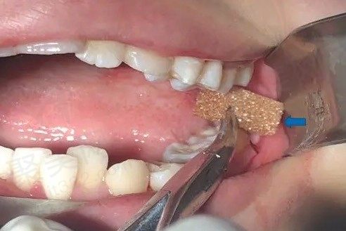 WechatIMG13804