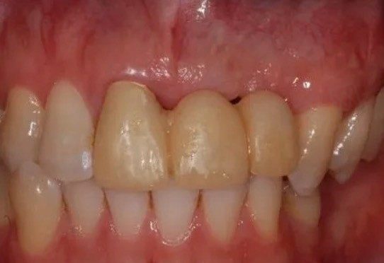 WechatIMG13854