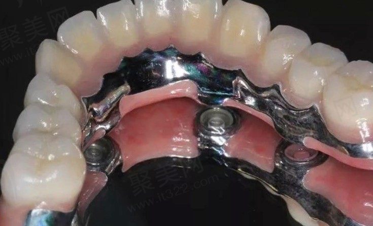WechatIMG13905