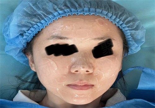 20岁可以做光子嫩肤吗？20岁推荐做什么医美项目？