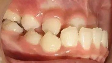 WechatIMG14006