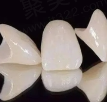 根管治疗后做全瓷牙还是烤瓷牙？烤瓷牙和全瓷牙哪个使用时间长？