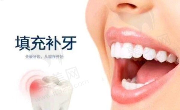 深圳优悦口腔补牙多少钱？美国3M树脂补牙188元起
