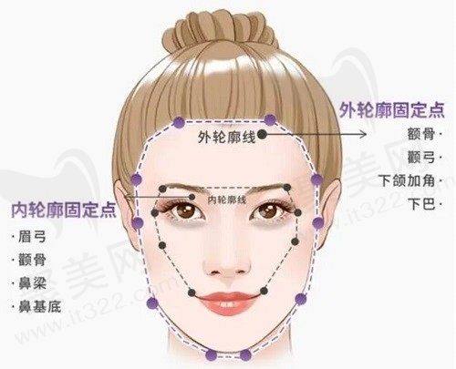 蒋铮铮打玻尿酸的价格：玻尿酸幼态脸打造2w+,轮廓固定5万元起