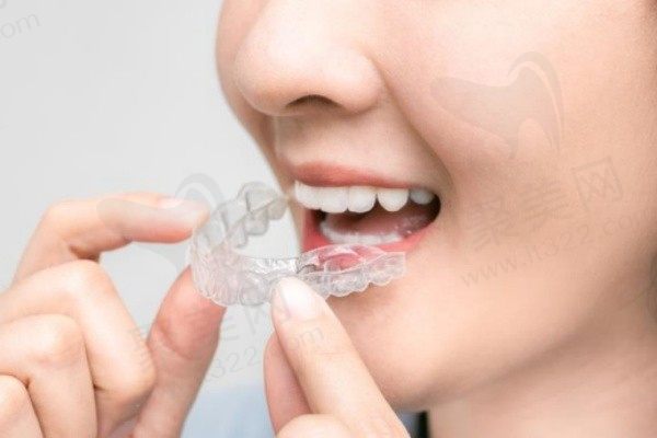 荆州咿呀牙科做隐适美隐形矫正价格只要22800元起，美观又舒适！
