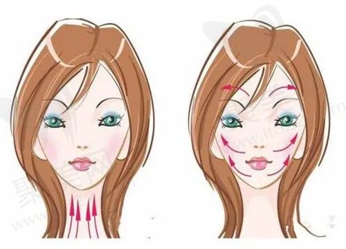 上海何晋龙的磨骨失败概率低审美好，分享一些新版何晋龙磨骨案例