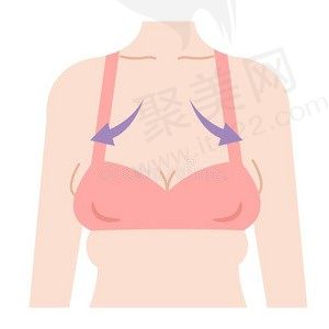 乳房悬吊术多少钱？看胸下垂做悬吊前后对比图以及多久恢复