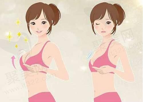 揭晓南京夏建军和黄名斗哪个技术好？极速假体隆胸参考价格优势在线预约