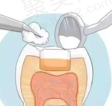 佛山哪里补牙可以用医保？点击查询佛山可用医保且正规的口腔医院