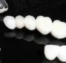 氧化锆全瓷牙可以做核磁共振吗？氧化锆全瓷牙的优缺点是什么？