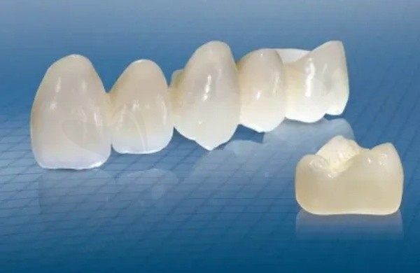 比较实惠的全瓷牙冠有哪些？全瓷牙冠便宜和贵的有什么区别？