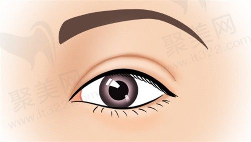 师丽丽修复双眼皮怎么样?从双眼皮修复案例看修复成功率大价格不贵