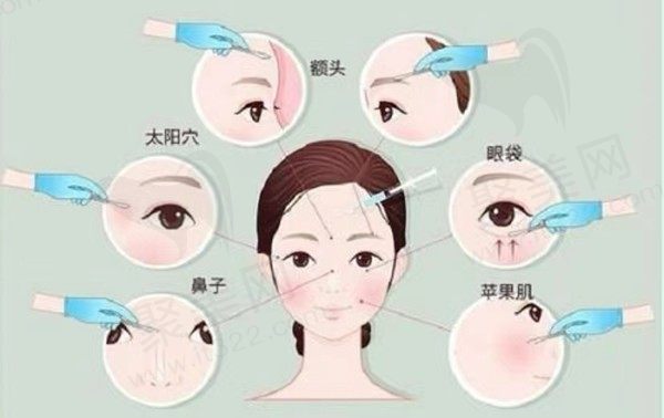 瑞蓝唯瑅打完结块怎么处理？打完后续还需要基础水光保养吗？