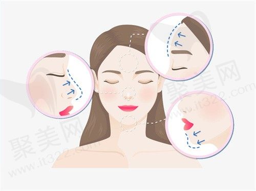 重庆美仑美奂做鼻子怎么样?毋巨龙擅长微创骨再生术隆鼻口碑超好