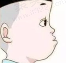儿童地包天矫正后复发率高吗？乳牙地包天恒牙还会地包天吗？