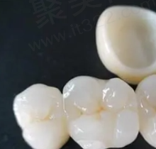 爱尔创全瓷牙和美晶全瓷牙哪个好？解析两者优缺点发现都不错