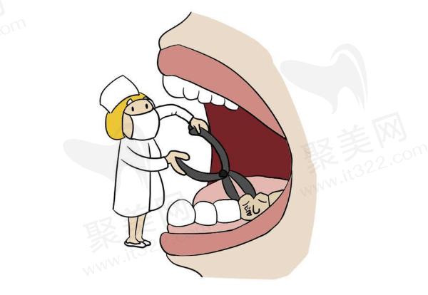 乳牙拔了需要做间隙保持器吗？费用多少？要戴多久？要注意什么？