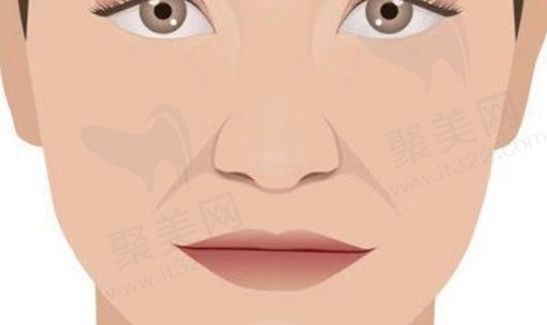 口周年轻化整形美容的常用方法有哪些？做完口周年轻化能维持多久？