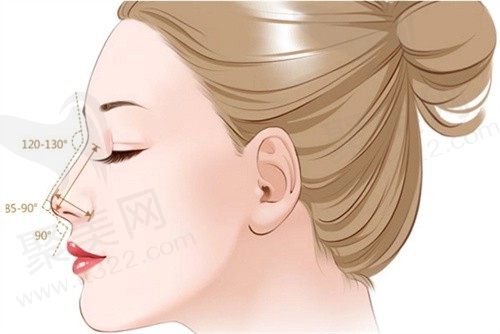 南京美莱郭心怡医生双拱蝶状仿生鼻综合3.8W起，自然仿生更高级一生只做一次鼻