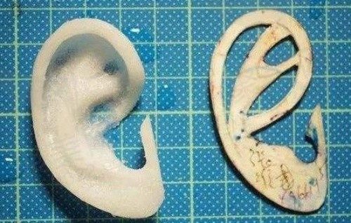 广东药科广州复星禅诚万伟东耳再造5w元起，矫正天生耳朵畸形