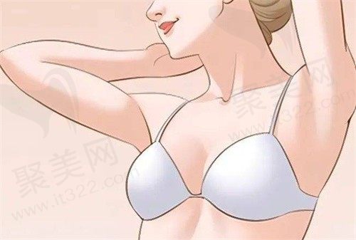 栗勇隆胸到底好不好?全国排名前十隆胸技术好无需插引流管术后即刻变软
