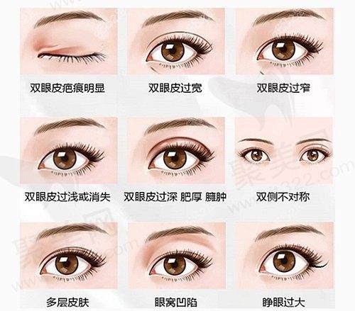 上海薇琳杨荣华医生RE-超IN妆感综合美眸13800元，5D全效开大动态妆感翘睫