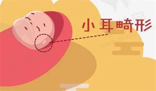 北京耳再造哪家医院好?北京米兰柏羽郭志华Su-por生物支架耳再造创伤小成效好