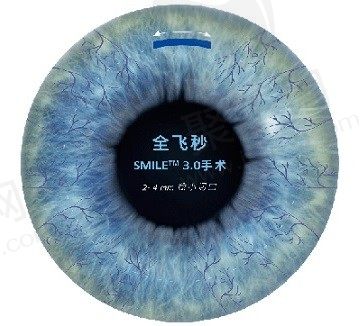 大连爱尔眼科医院院长谭永和做全飞秒近视手术好，价格只要19800起