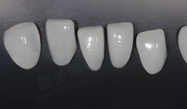 烤瓷牙贴面对牙齿有影响吗？烤瓷牙贴面能维持多久,时间久了会有什么副作用