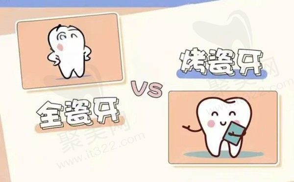 烤瓷牙掉了还能粘上吗？烤瓷牙与全瓷牙的区别和优缺点汇总