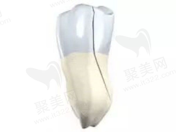 门牙有裂纹能撑几年？是什么原因导致的？有什么治疗方法吗？