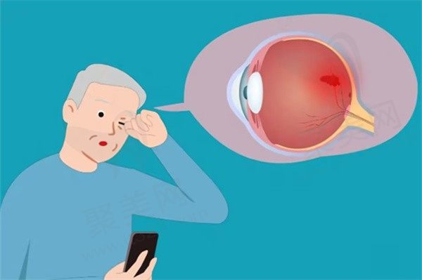 糖尿病可以做白内障手术吗？手术有风险吗？术后注意事项解答