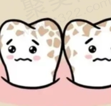 儿童氟斑牙怎么形成的？儿童氟斑牙怎么治疗，要花多少钱？