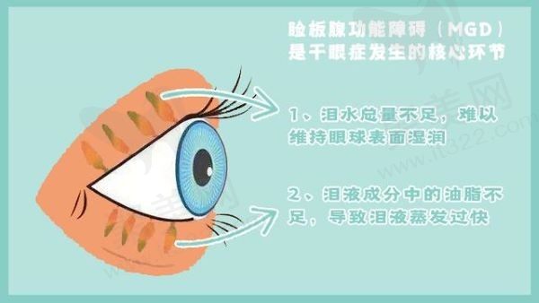 睑板腺萎缩了还能恢复吗？一般是可以的，主要看腺体萎缩的程度