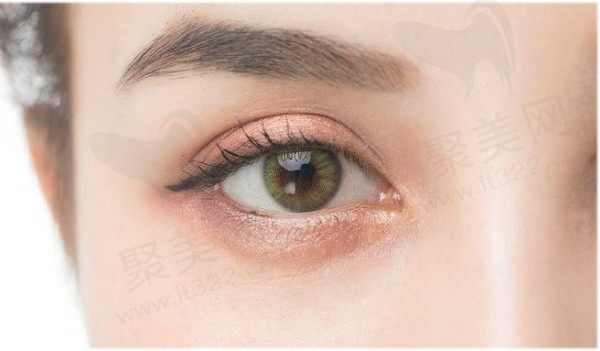 深圳鹏程医院割双眼皮信得过吗?14年技术+网友真实评价值得信赖！