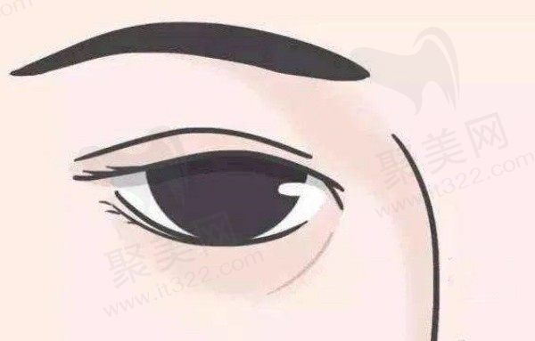 弗缦1ml够填充两只泪沟吗？想知道弗缦胶原蛋白填充泪沟能维持多久？