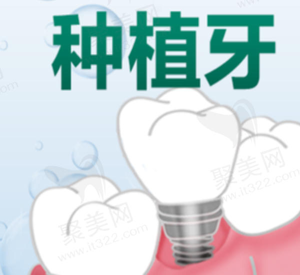 黔南州种植牙医保报销吗？黔南州种植牙价格及报销比例揭晓