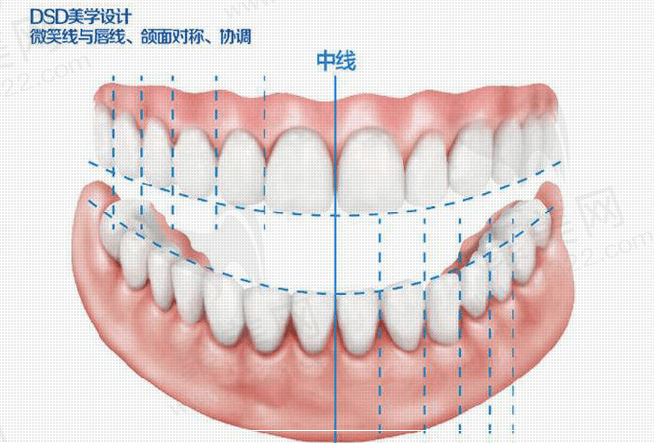 拜博口腔DSD微笑美学设计