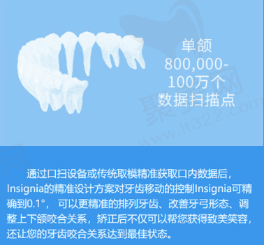杭州齐尔口腔Insignia精因矫治
