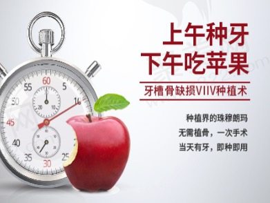 鼎植口腔特色项目-穿颧穿翼VIIV种植