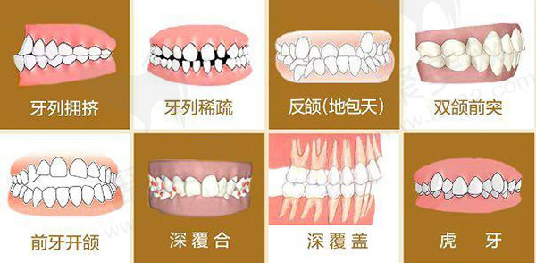 18岁后：恒牙期，牙齿矫正没有时间限制