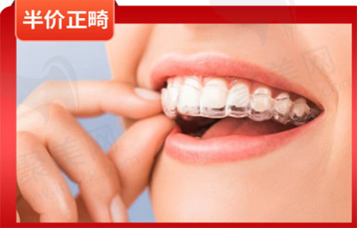 半价矫牙