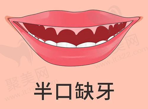 半口缺牙