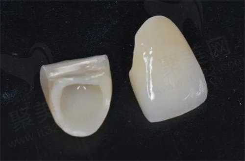 全瓷牙
