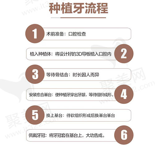 广州德伦口腔种植牙流程