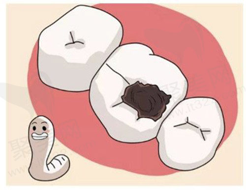虫牙