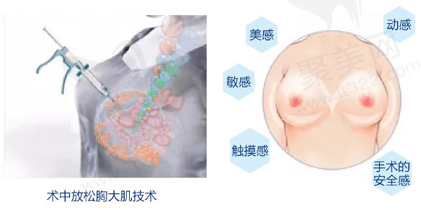 术中放松胸大肌技术